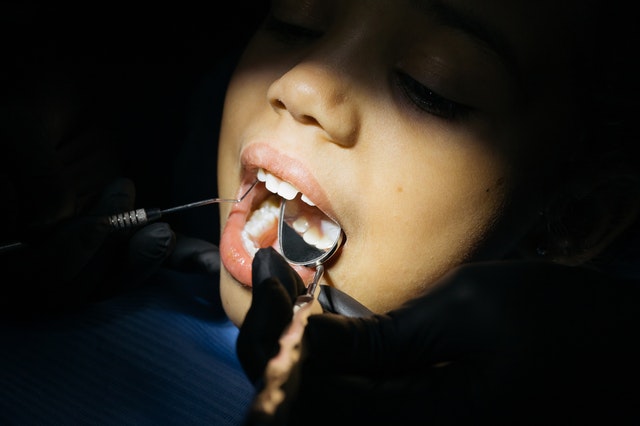 sensibilitate-dentara